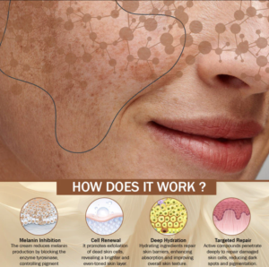 hyperpigmentation cream