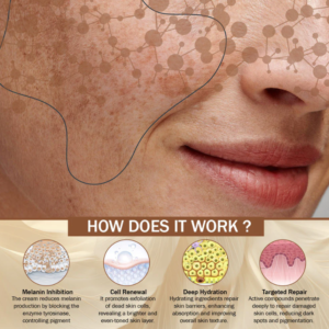 hyperpigmentation cream